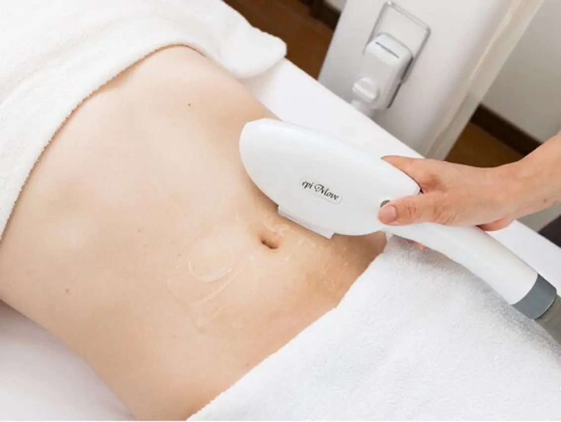 《新規女性VIO脱毛》痛みの少ないデリケートゾーン美肌脱毛¥4800→¥3800の写真