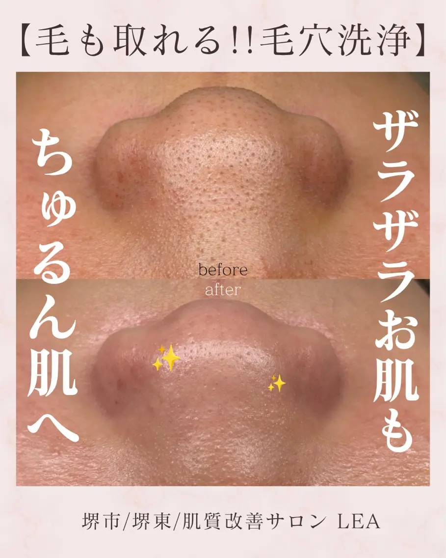 エステ Lea堺東 眉毛| 毛穴洗浄|顔WAXの眉毛・アイブロウイメージ