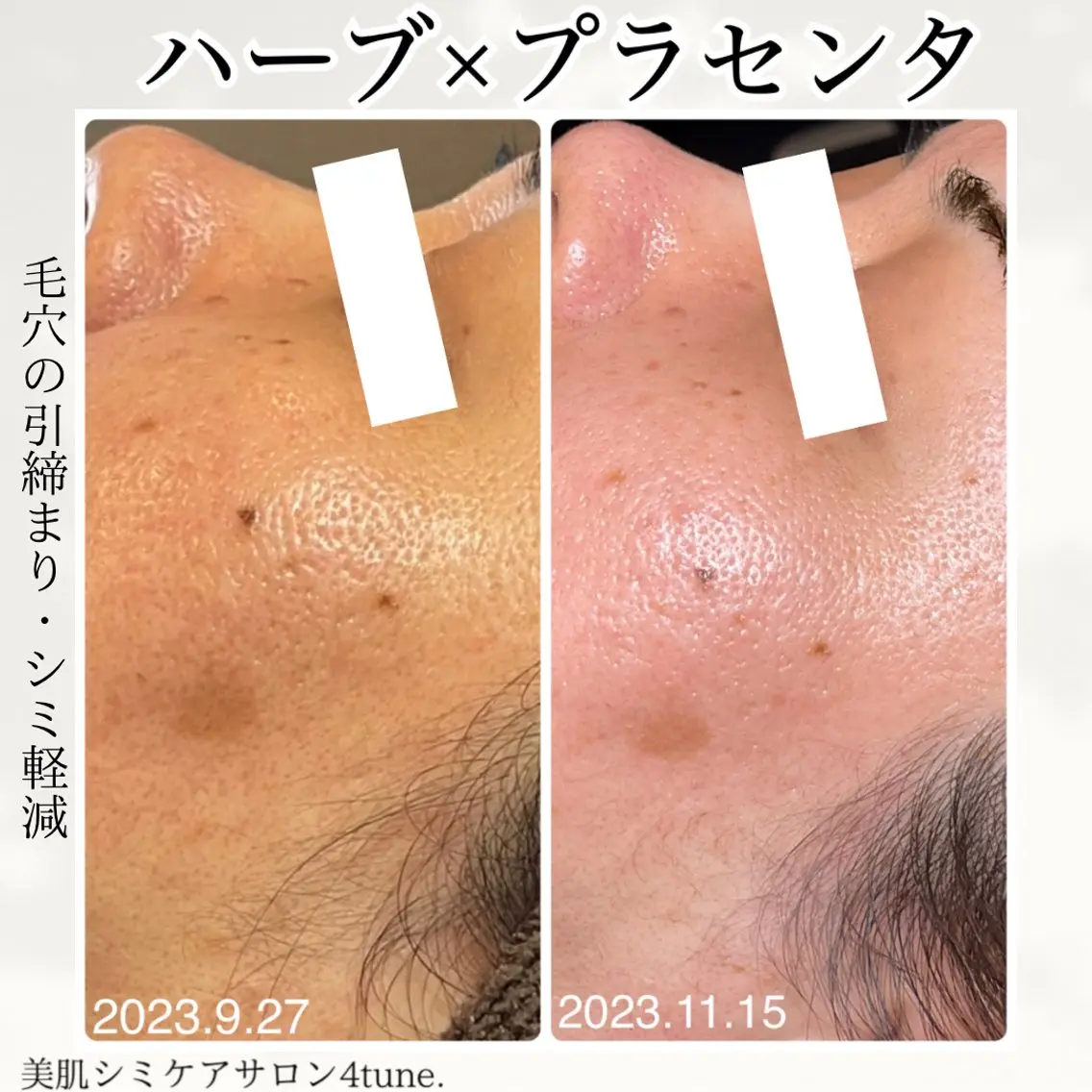 美肌シミケアサロン 4tune.RUMIのその他イメージ