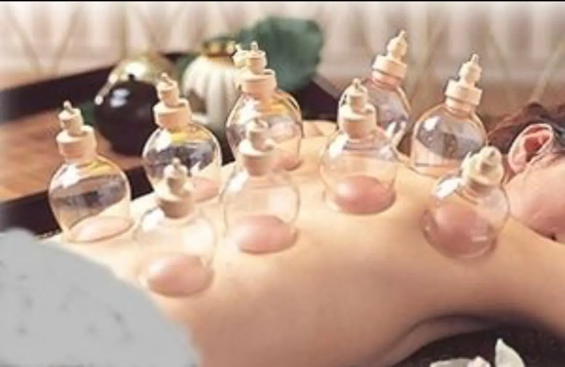 健康吸玉療法・筋膜リリースカッピングの写真