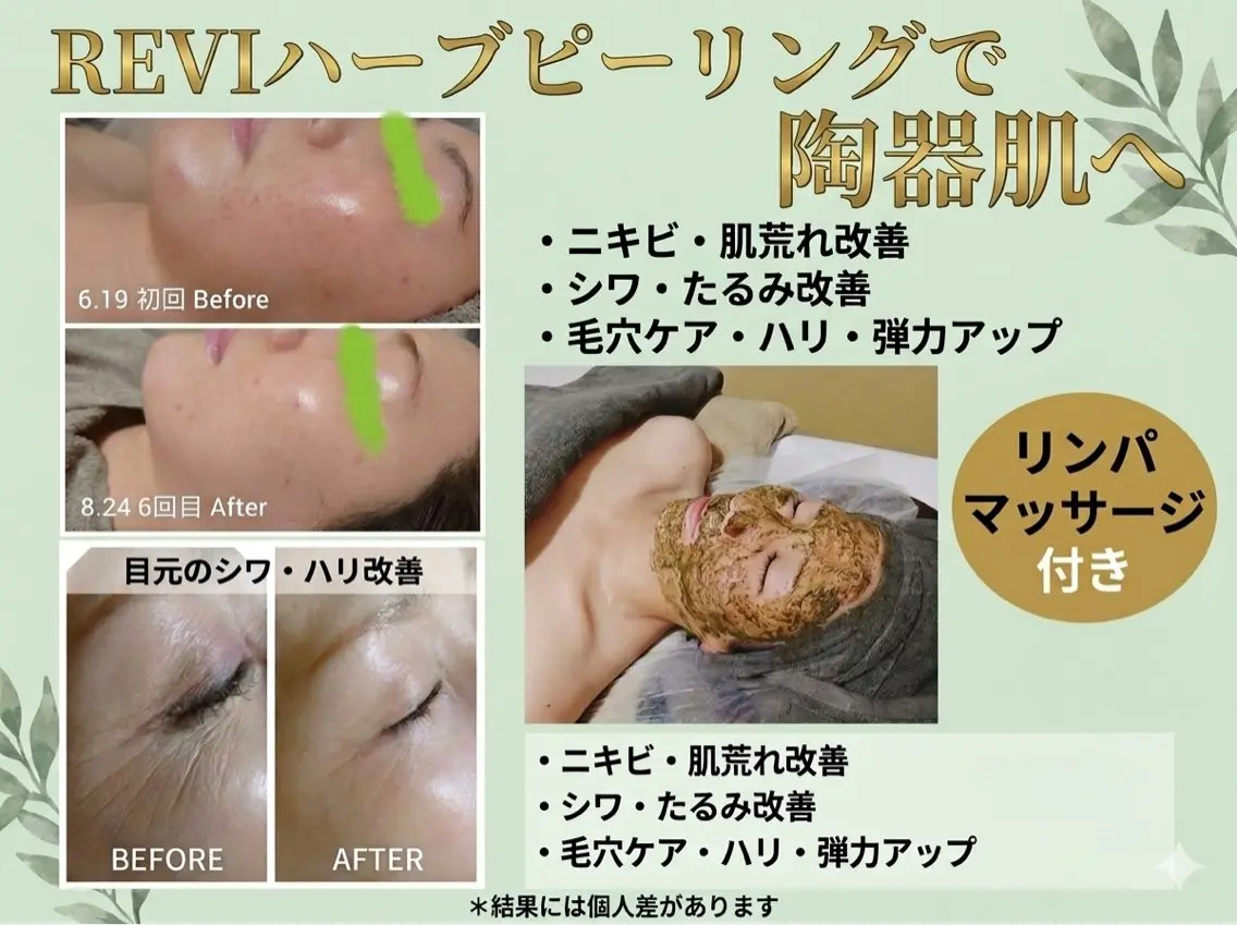 エステ Luanaまつパ脱毛 ハーブピーリング眉毛のマツエク・マツパデザイン