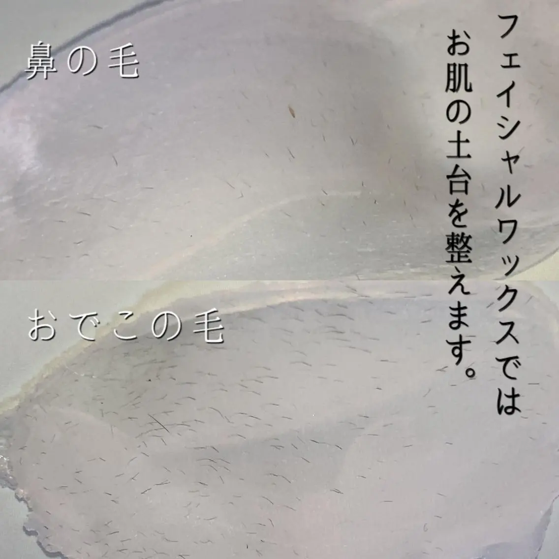 脱毛サロン KiWiのエステ・リラクイメージ