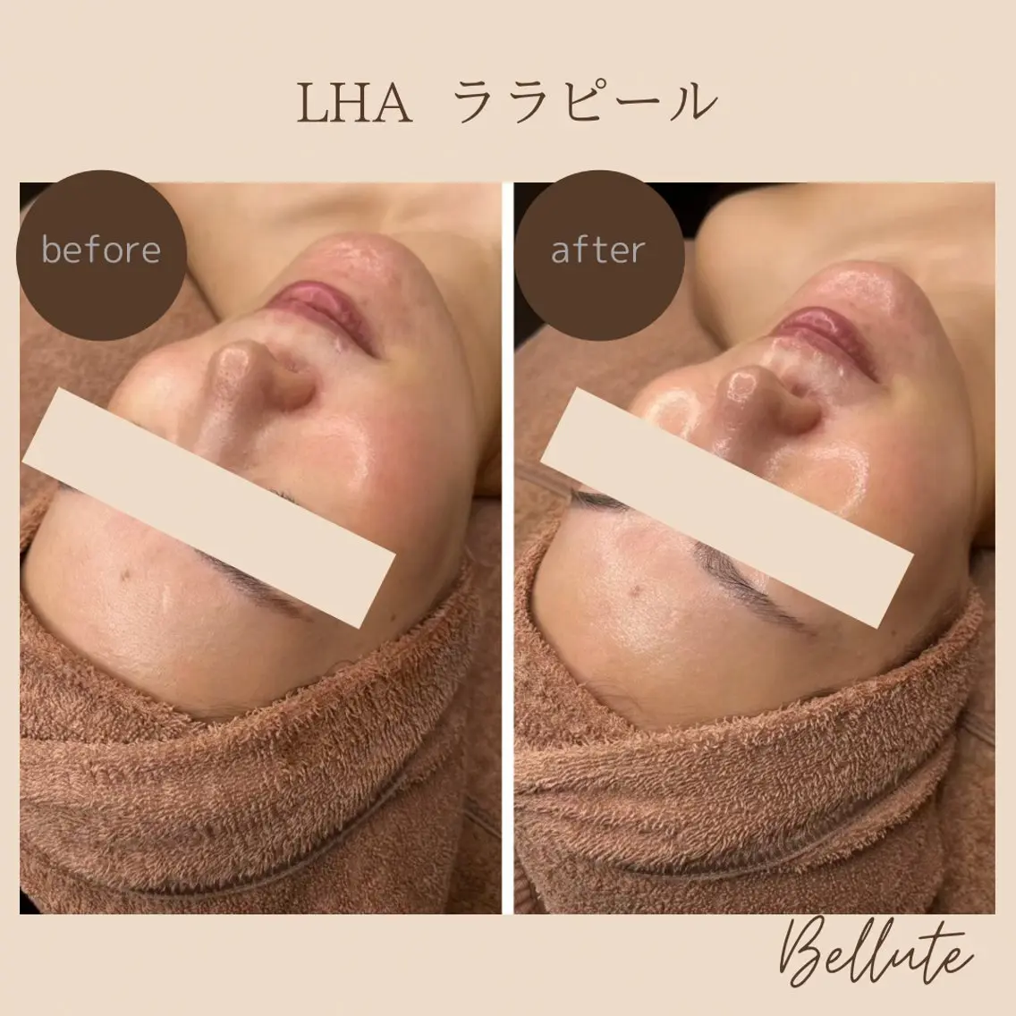 エステ ピーリング専門店 Belluteのエステ・リラクイメージ