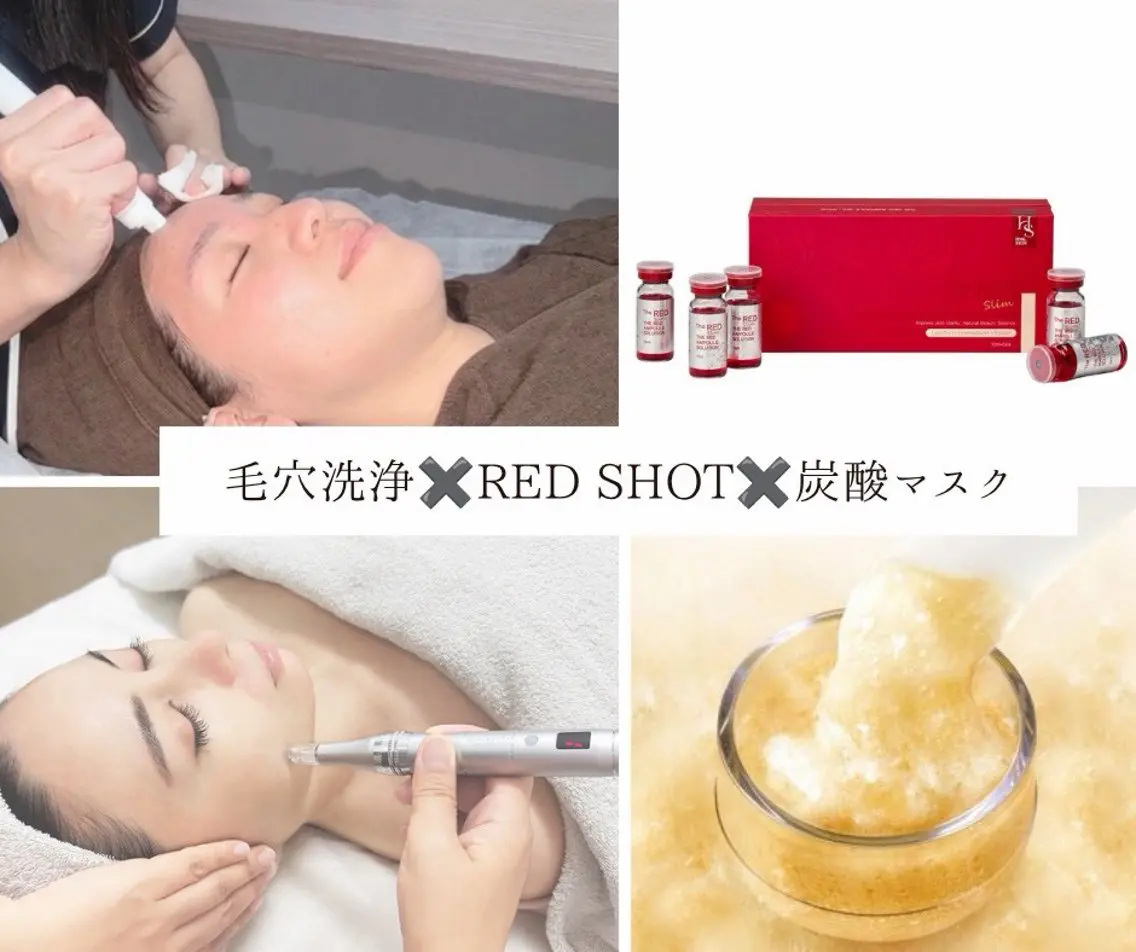【ツヤ/小顔】毛穴洗浄➕レッドショット(2cc)➕炭酸ジェルマスク¥19,600→¥11,000の写真