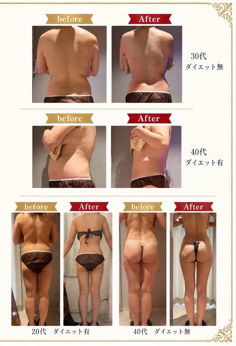 癒しゼロ！熱血エステ FEMBE千葉駅前店のエステ・リラクイメージ