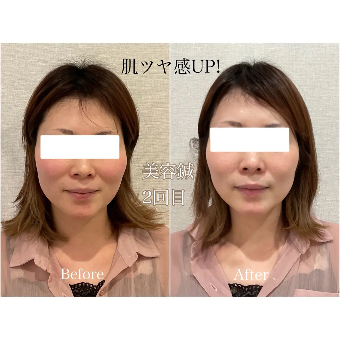 その他 けい整骨院 鍼灸院のその他イメージ