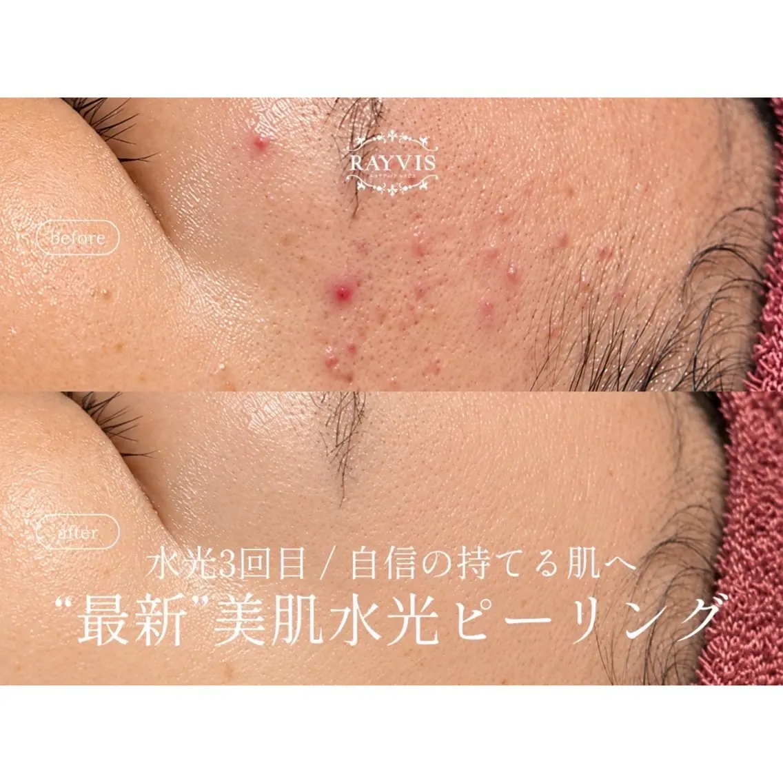 エステ レイビス盛岡店 ♡吉田♡のエステ・リラクイメージ