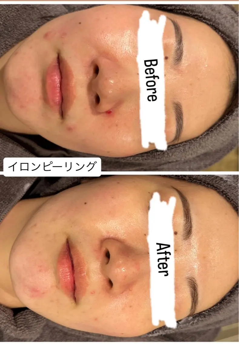 その他 桐山 まどかのエステ・リラクイメージ