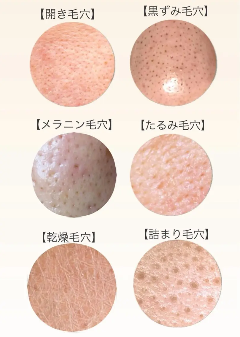 エステ リラク 肌管理サロン vidyto　MOEのエステ・リラクイメージ