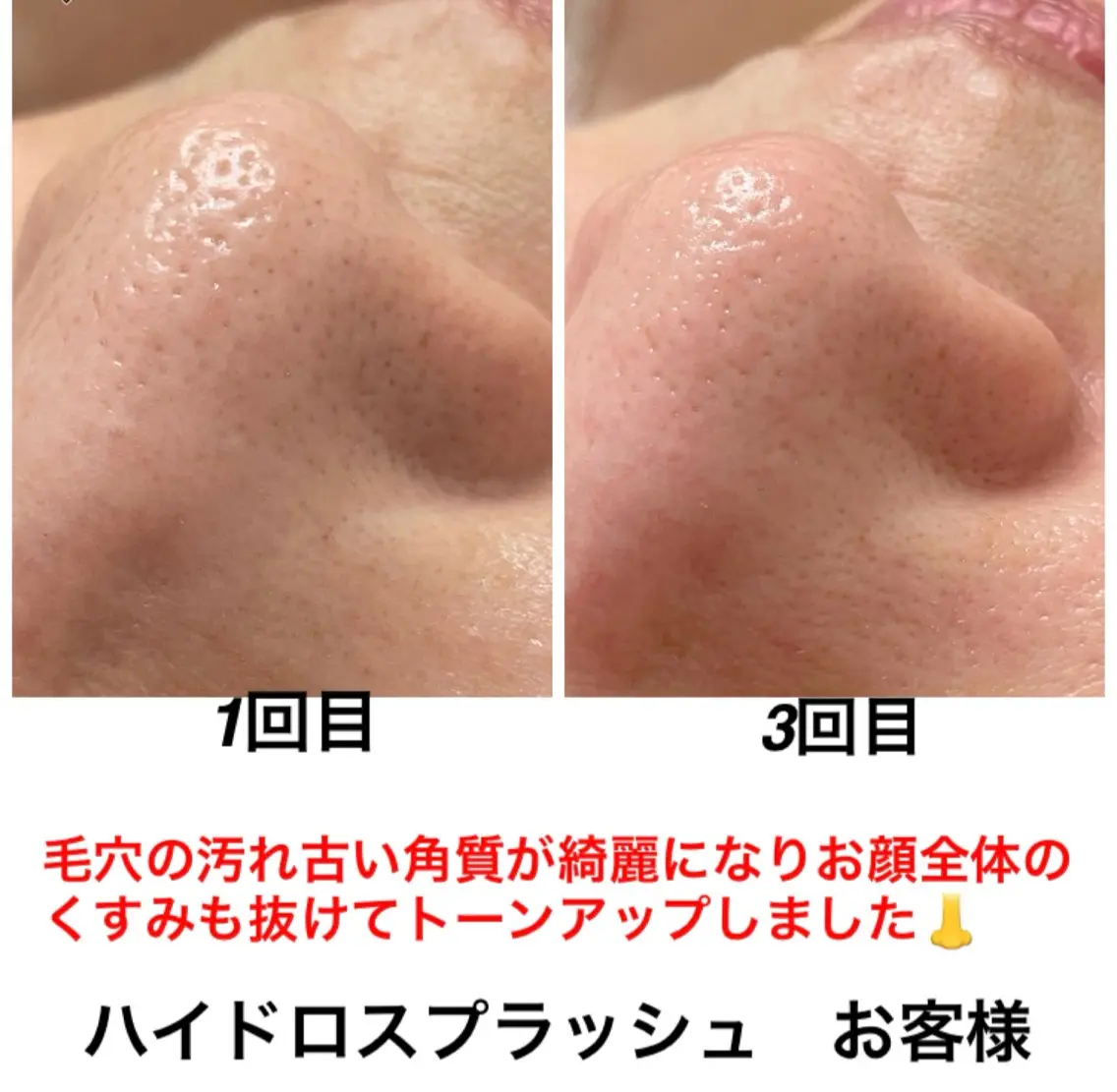 エステ リラク ネイル・エステサロン UILANIのエステ・リラクイメージ