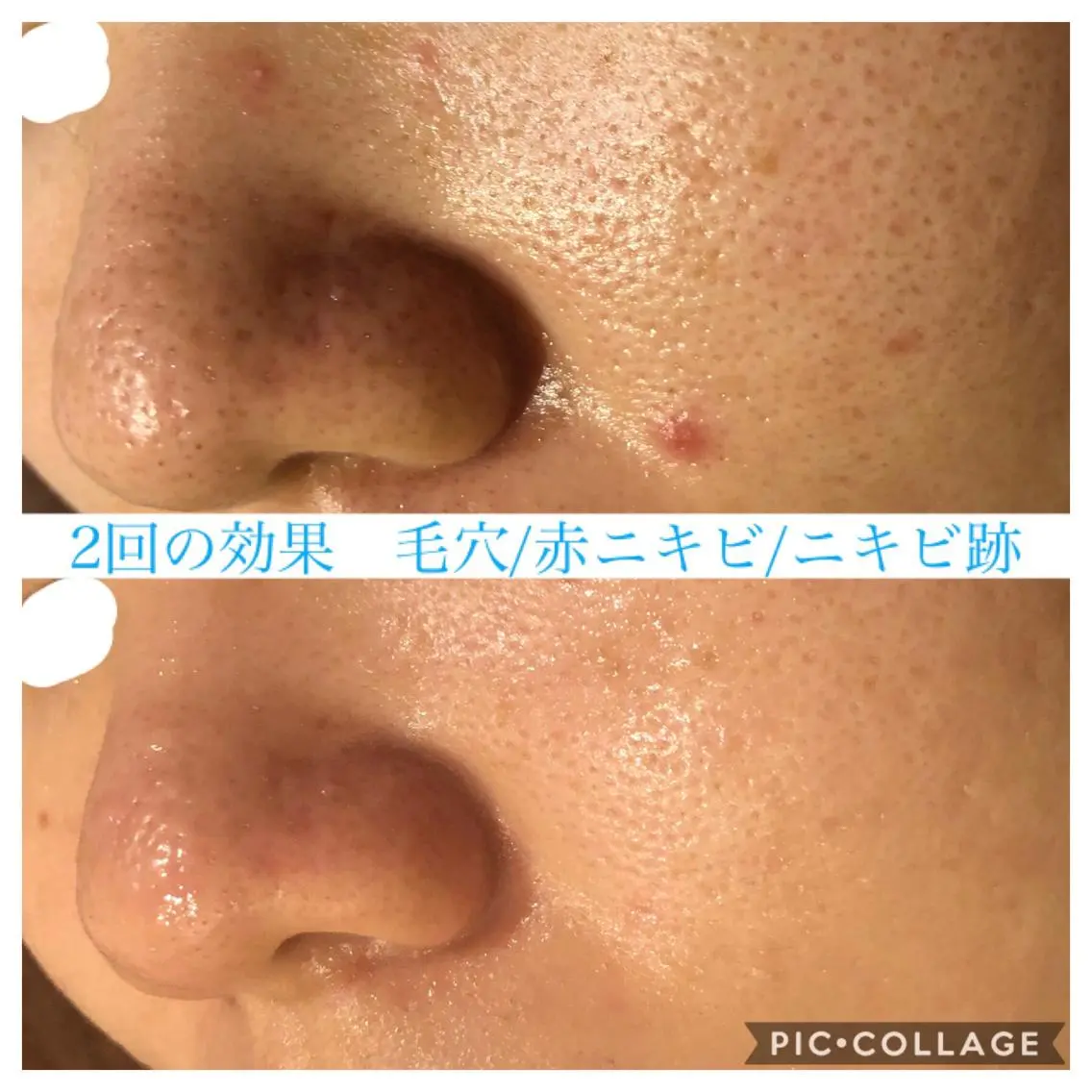 ロング カラー パーマ ヘアアレンジ キッズ ネイル マツエク・マツパ エステ リラク EnsorClair 代表　野口真央のエステ・リラクイメージ