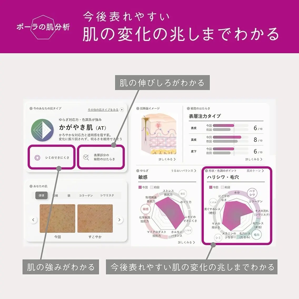 最新のAIとカメラを使った肌カウンセリング✨の写真