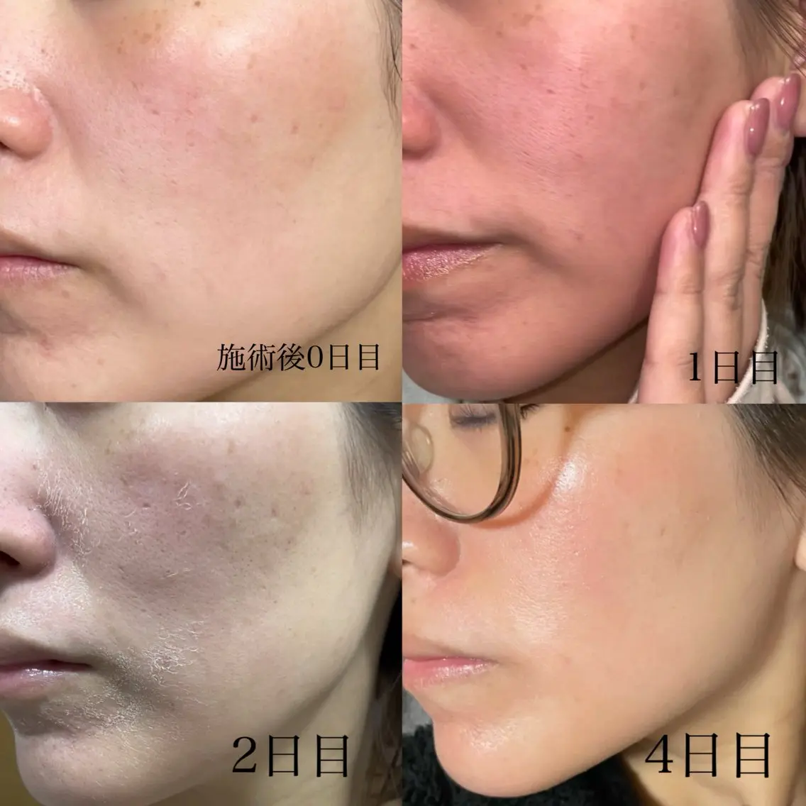 エステ SALON el 歯と肌の専門店のエステ・リラクイメージ