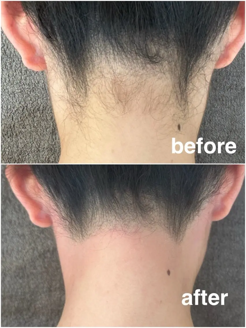 【うなじWax✨技術向上のための練習モデル募集】の写真