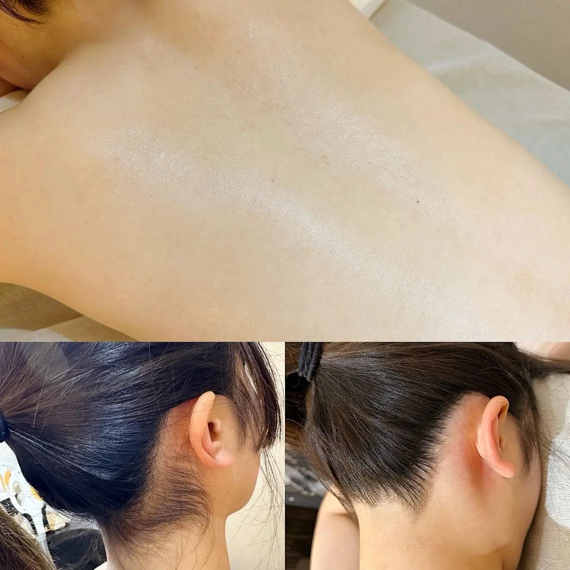 『背中✕うなじ脱毛(シェービング付)』自己処理が出来ない部位がセットに🌞✨️の写真