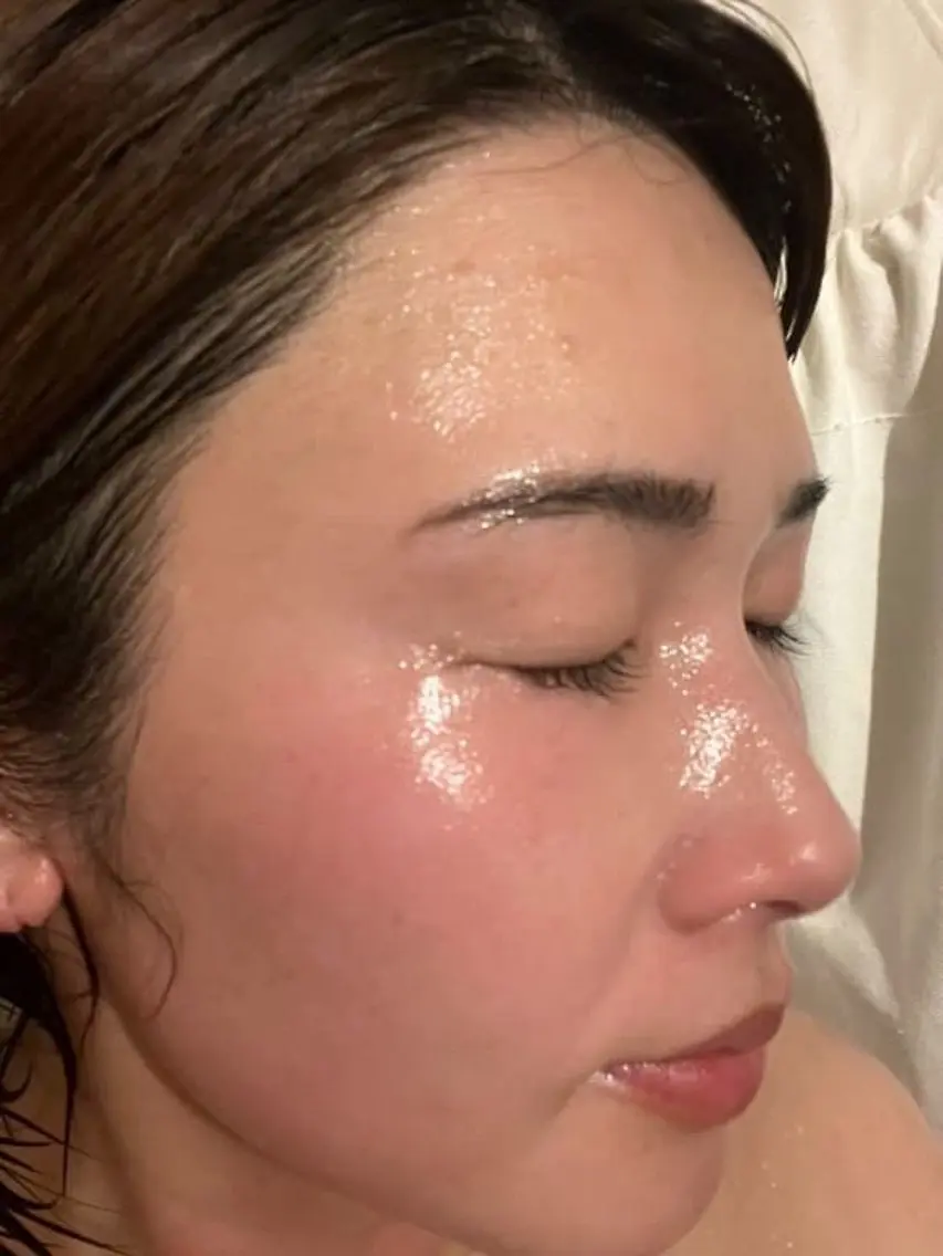花粉 肌荒れに😖ハーブテント美肌ブレンドで『赤み.痒み.湿疹.カサゴワ肌改善💖』冬に溜め込んだ老廃物をデトックス🌿の写真