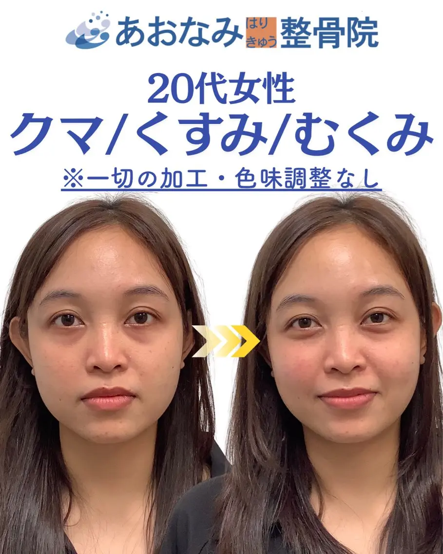 メンズ ハーブピーリング &美容鍼のエステ・リラクイメージ