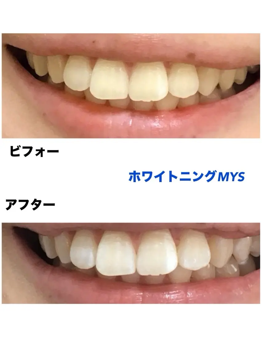 ホワイトニングMYS 北千住店のその他イメージ