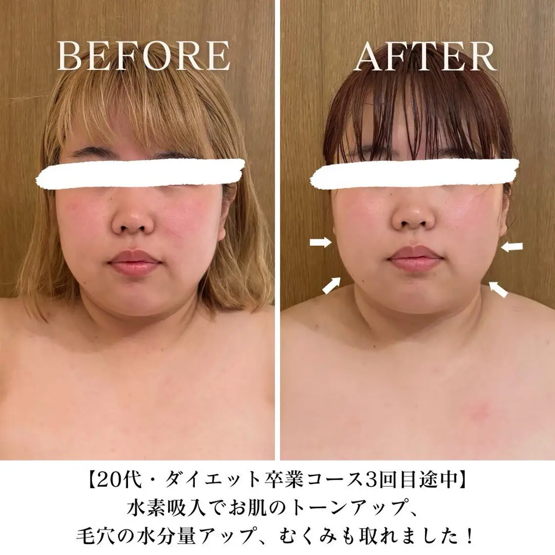 【目黒】本格痩身✴︎ 最新型よもぎ蒸しのエステ・リラクイメージ