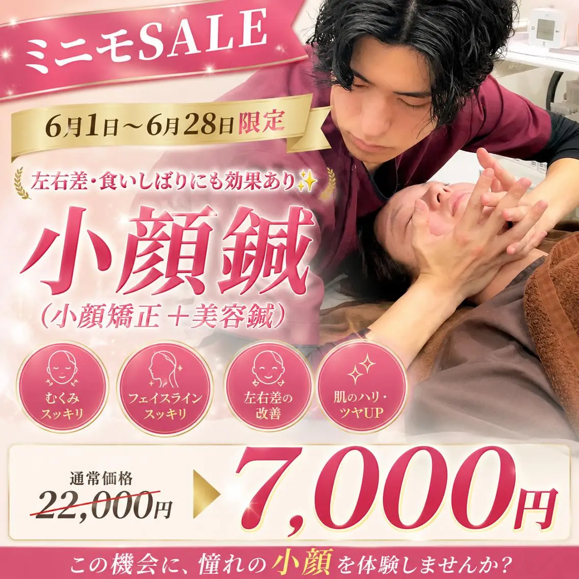 【6月1日~28日限定！】【浮腫み/左右差/フェイスライン】120分⭐️美容鍼＋小顔矯正＋フェイシャルマッサージの写真