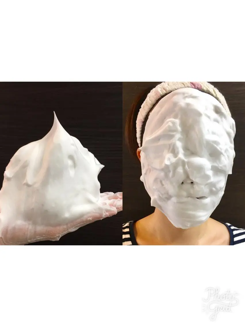 🍀学割🍀ニキビケア3回プログラムの写真