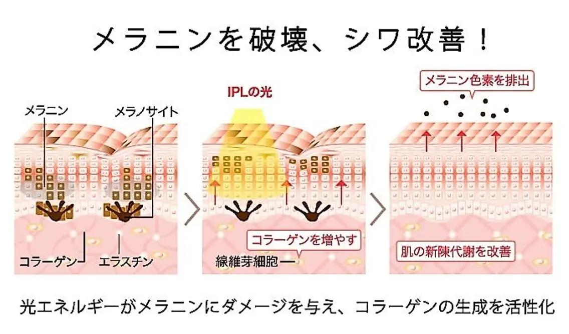 aliaハーブ水光店 エステティシャン募集のエステ・リラクイメージ