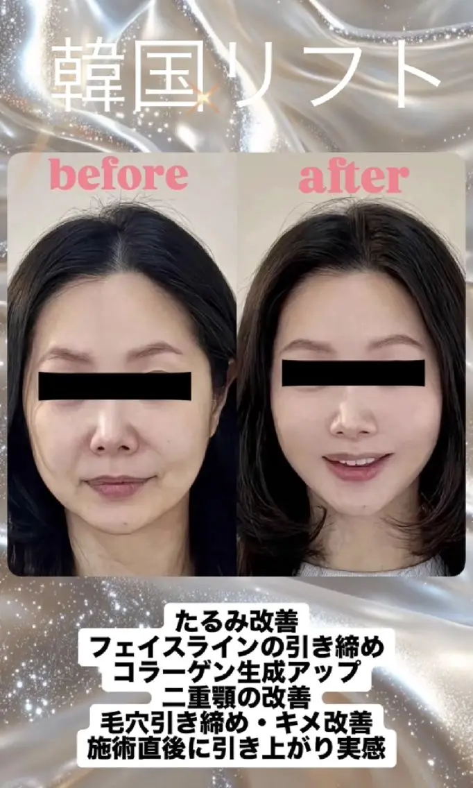 マツエク・マツパ エステ 愛維美水光専門店 川崎彩鳳のエステ・リラクイメージ