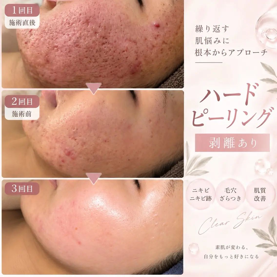 エステ totalsalon lienのエステ・リラクイメージ