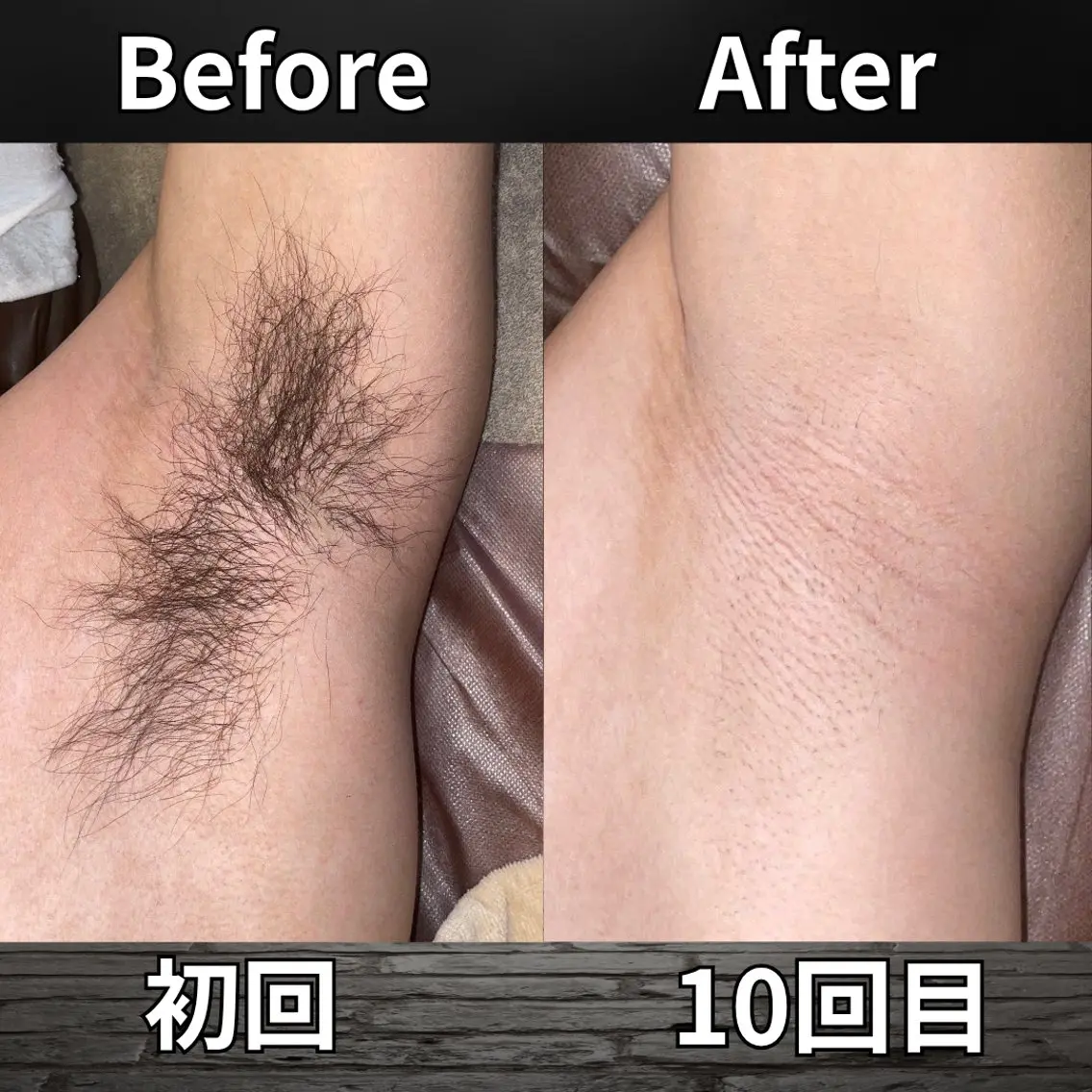 脱毛 渡邉 晟のネイルデザイン