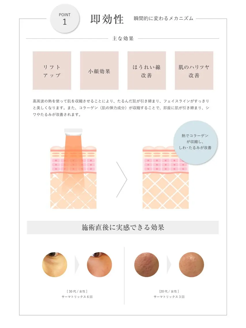 ⭐️リフトアップ効果実感/お試し価格⭐️【サーマトリックス/オリジオ同様効果】しわたるみ改善!お好きな部位3パーツ💎の写真