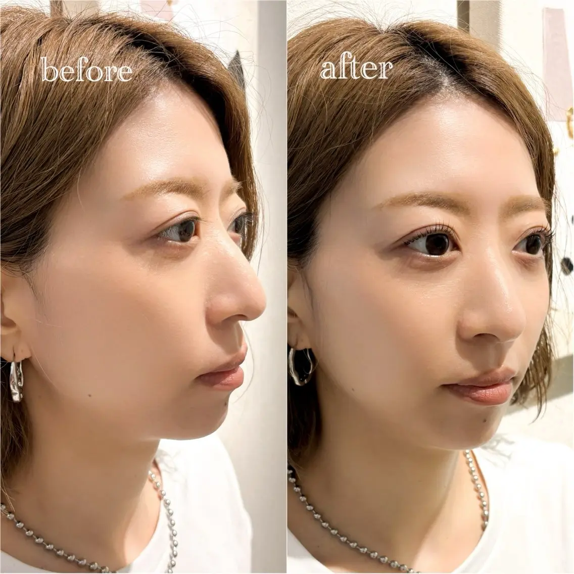 マツエク・マツパ パリジェンヌラッシュリフト マツパ eyelash iona♡ Ruiのマツエク・マツパデザイン