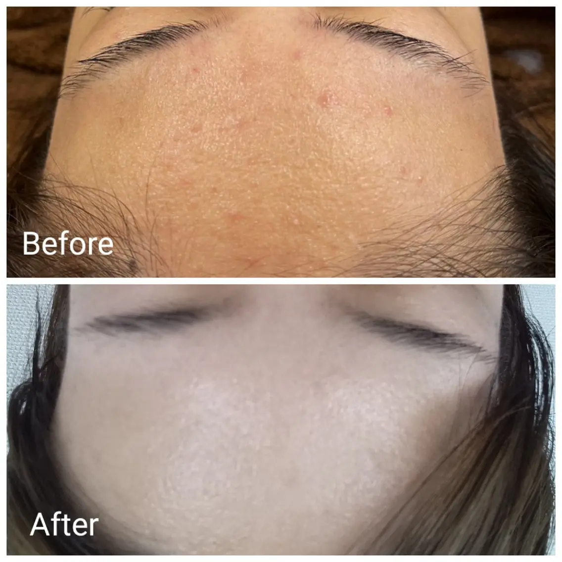 肌質改善Beauty salon Renのエステ・リラクイメージ
