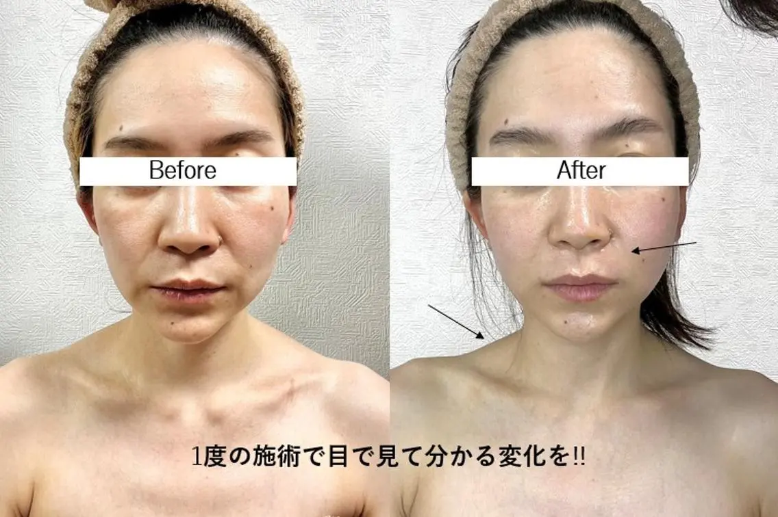 松本 富美子の眉毛・アイブロウイメージ