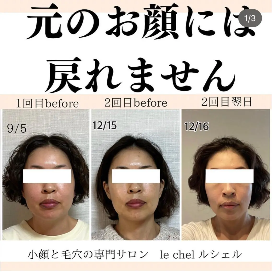 小顔・毛穴専門 ルシェルのエステ・リラクイメージ