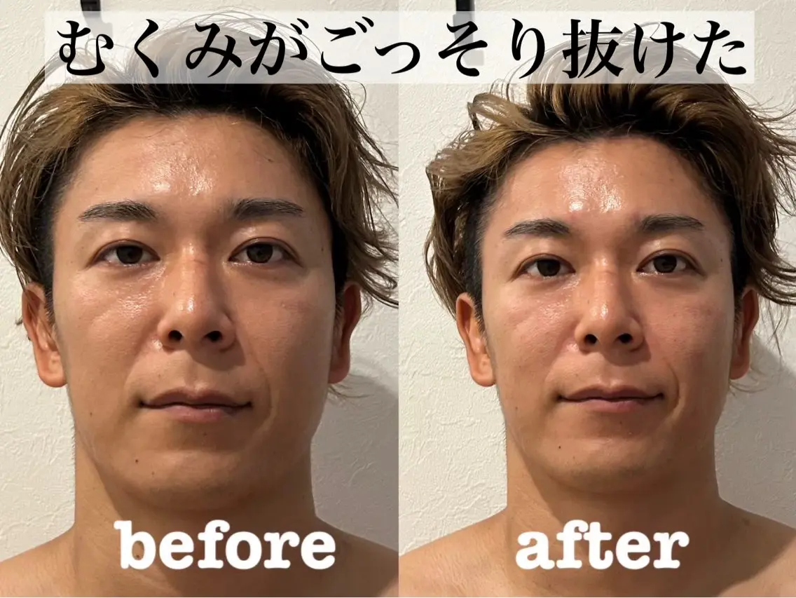 エステ リラク 大阪上本町 肌質改善×美容鍼ゆいのエステ・リラクイメージ