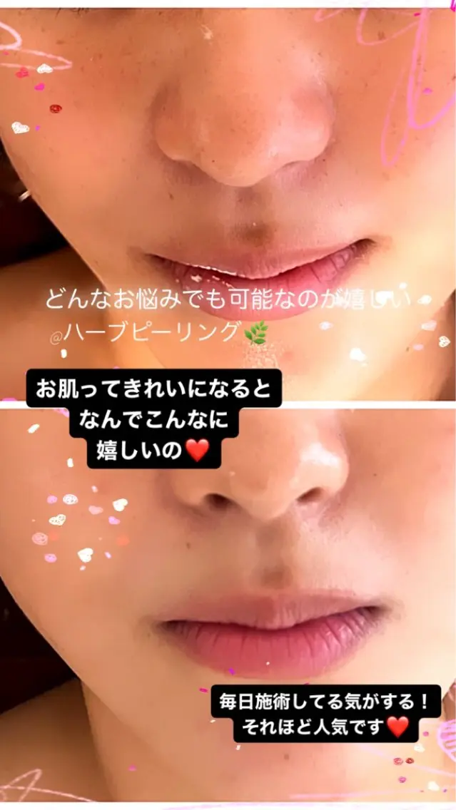 ❤️予約殺到❤️mi オールハンド痩身専門のエステ・リラクイメージ