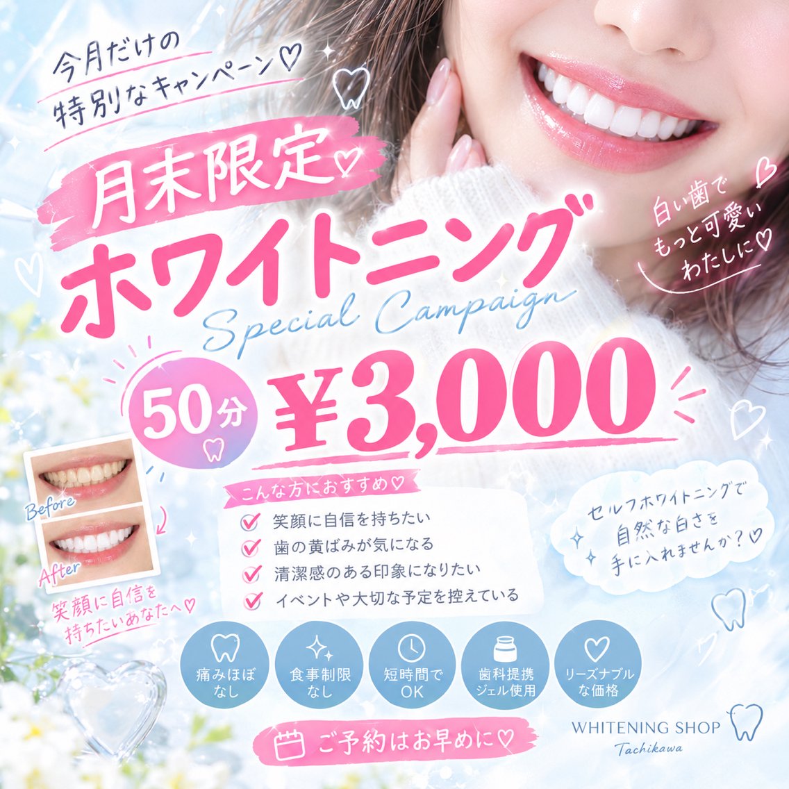 今月最後のお得なチャンス!50分照射 ¥3,000 笑顔に自信を🦷✨️白い歯で第一印象UP!!の写真