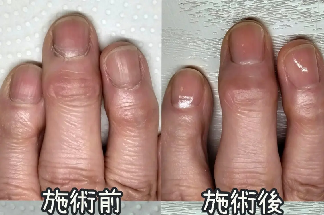 ネイル ハンドケア 【まみ】 Ka Pilinaのネイルデザイン