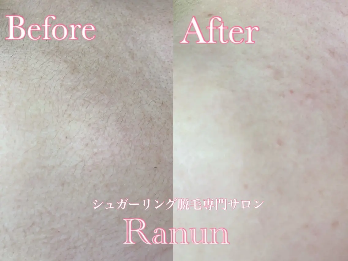 マツエク・マツパ 脱毛 シュガーリング脱毛 専門店Ranunのエステ・リラクイメージ