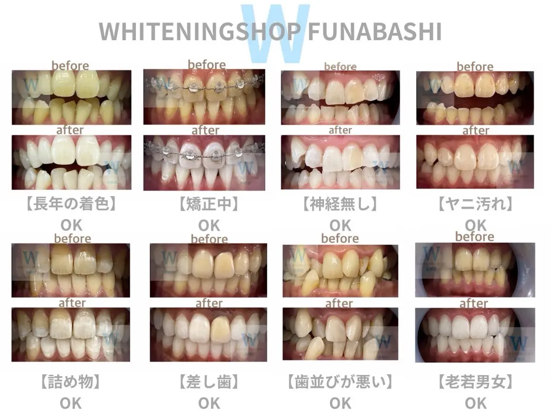 メンズ エステ リラク ホワイトニング ショップ本八幡店のエステ・リラクイメージ