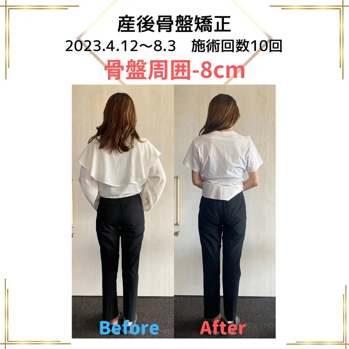 【6〜7月に出産されたママさん向け】産後骨盤矯正の写真