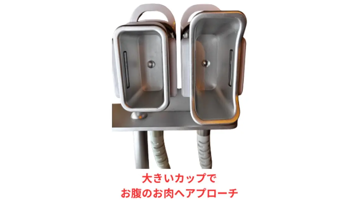 【期間限定】冷却痩身!お腹集中冷却(中・大2カップ)men's、お子様連れOK!6,800円!の写真