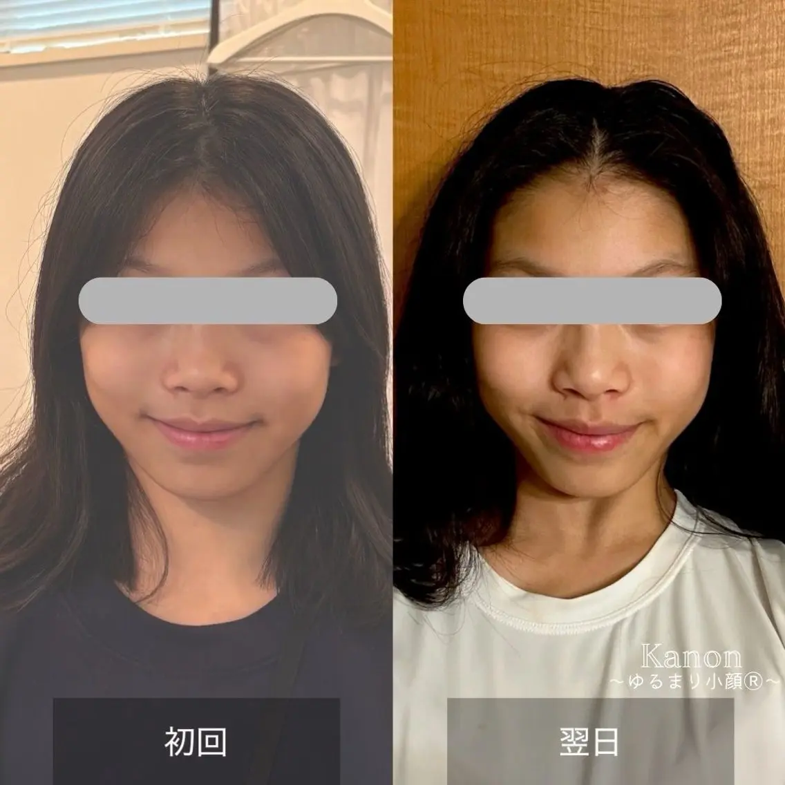 小顔矯正サロン町田 逸見智美のエステ・リラクイメージ