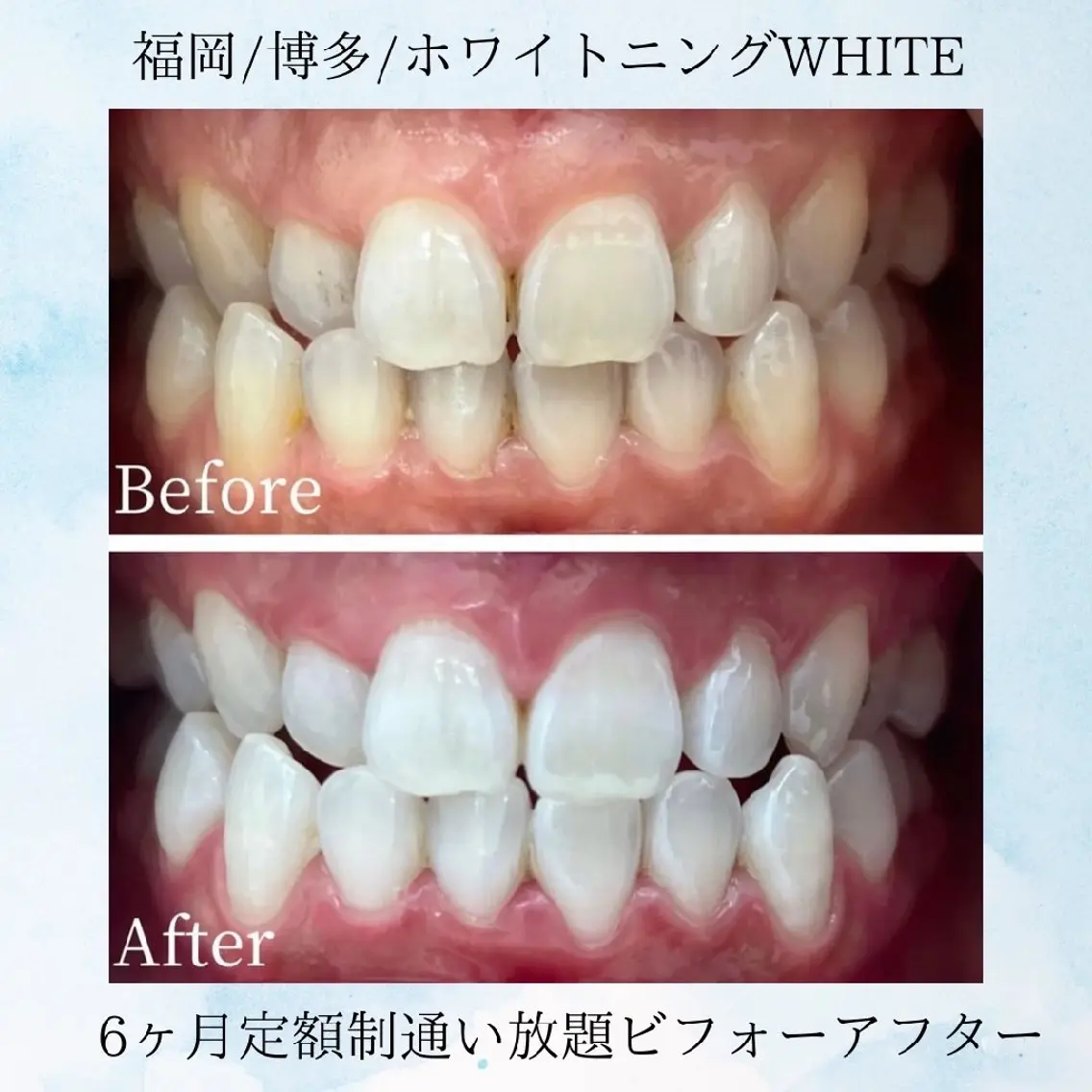 その他 セルフホワイトニング WHITE福岡博多店のエステ・リラクイメージ