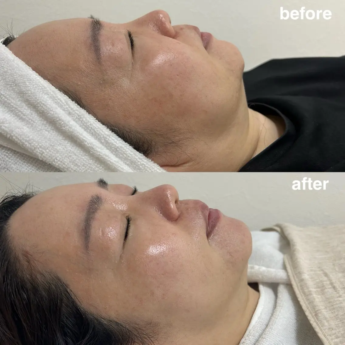 エステ salon moiのマツエク・マツパデザイン