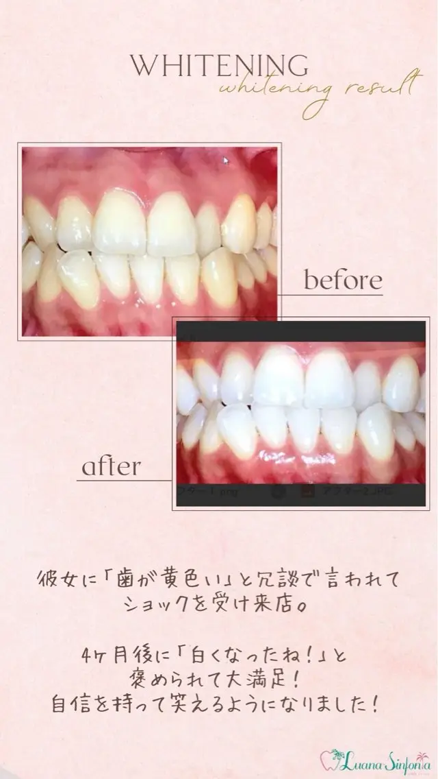 橋口 花菜子のその他イメージ