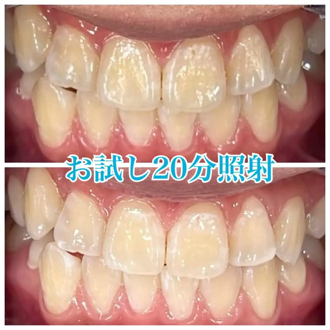 ホワイトニング🦷 ネイル💅LEAのその他イメージ