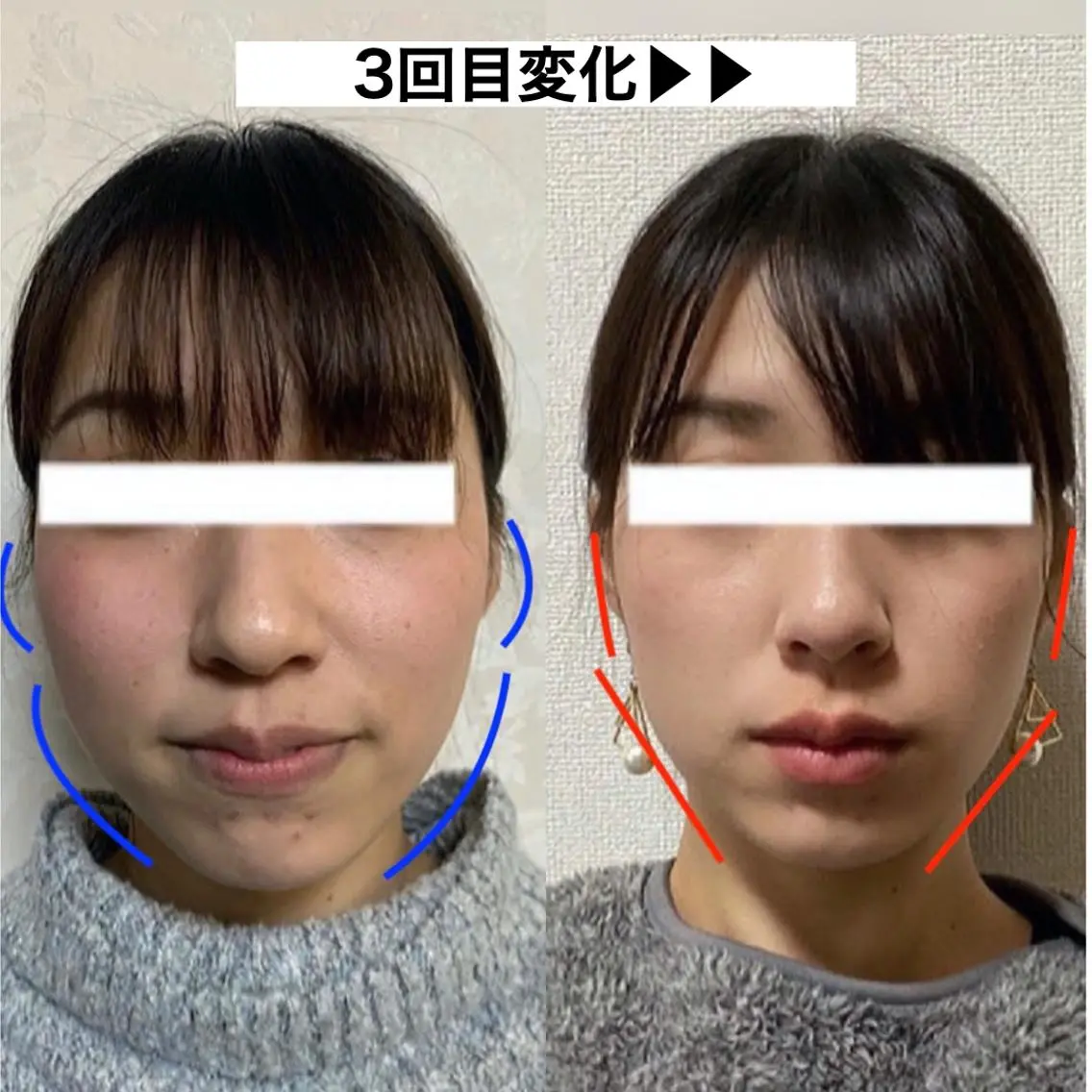 顔の歪み矯正専門 宮内翔のエステ・リラクイメージ