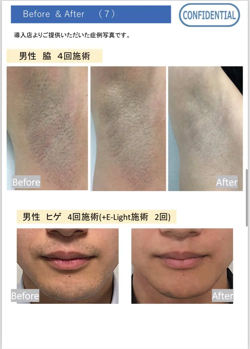 メンズ 脱毛 private salon meのエステ・リラクイメージ