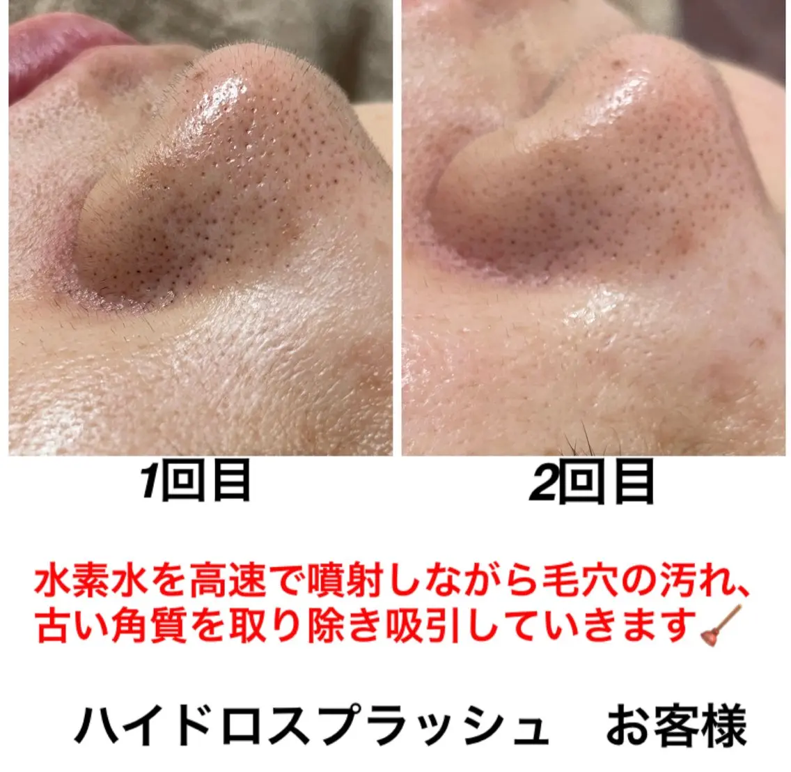 エステ リラク ネイル・エステサロン UILANIのエステ・リラクイメージ